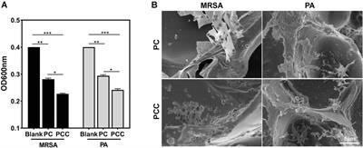 Carboxymethyl chitosan nanoparticle-modulated cationic hydrogels doped with copper ions for combating bacteria and facilitating wound healing